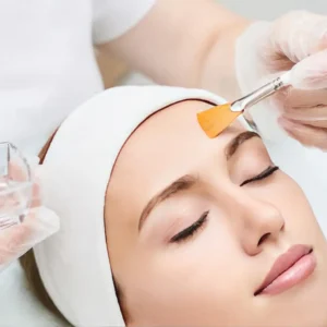 Peeling Químico Personalizado